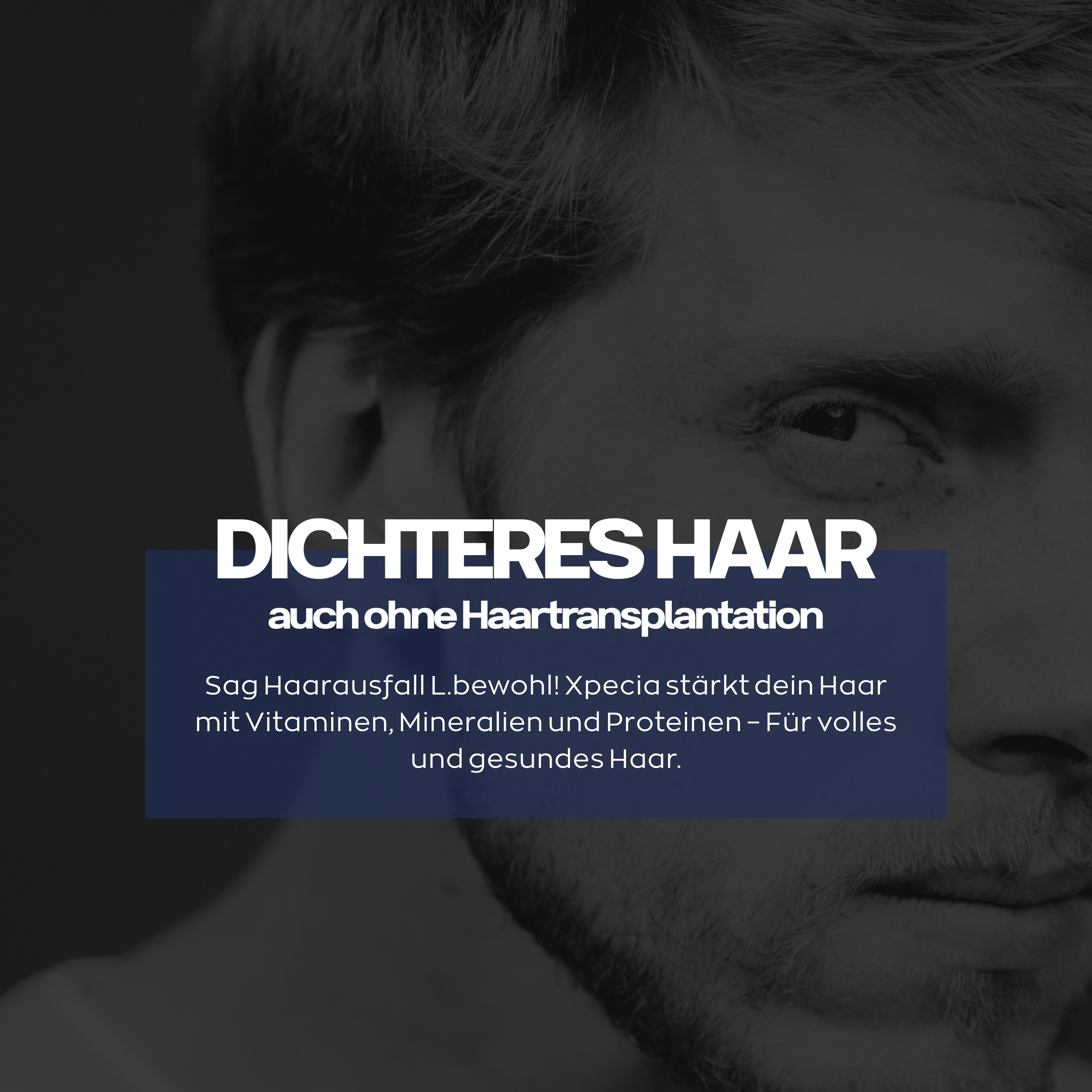 Xpecia Tabletten für Männer – Natürlicher DHT-Blocker gegen Haarausfall - 6 Stück